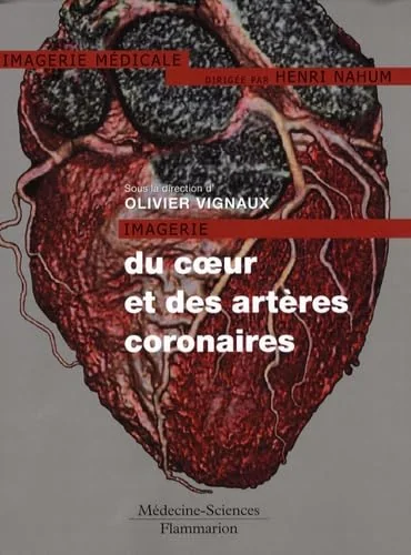 Imagerie du coeur et des artères coronaires