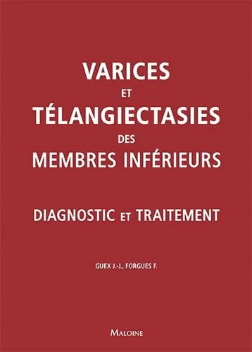 Varices et teleangiecasties des membres inferieurs: Diagnostic et traitement