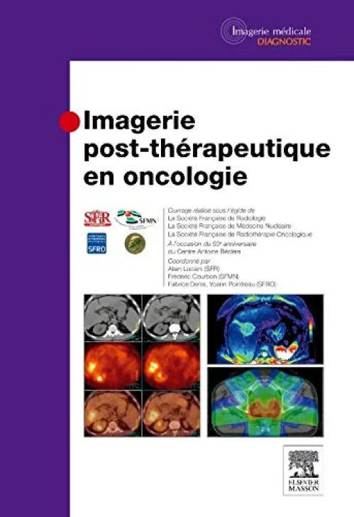 Imagerie post-thérapeutique en oncologie