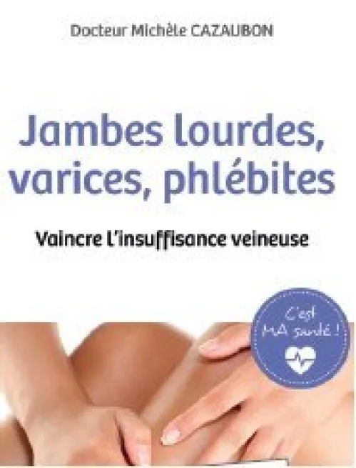 Jambes lourdes, varices, phlébites. Vaincre linsuffisance veineuse